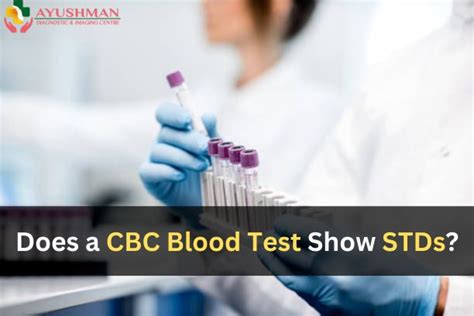 Does a Blood Test Show STDs? Exploring the Intricacies of Medical Diagnostics and Beyond